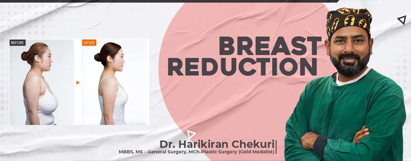 Breast Reduction