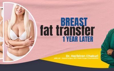 Breast Fat Transfer 1 Year Later