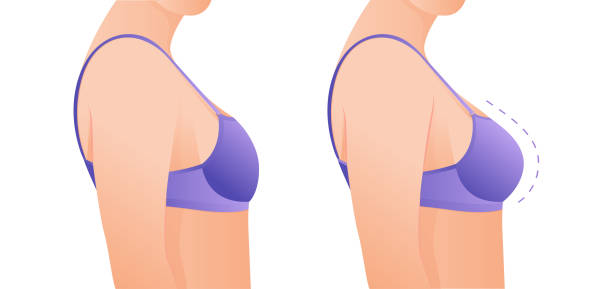  Success Rates of Breast Implant Surgery